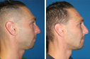Before & After Photos